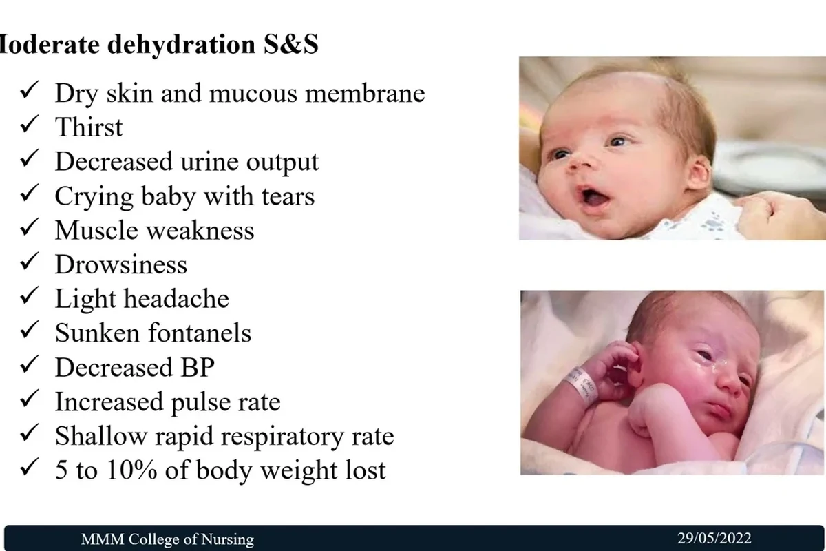 Newborn baby care scene showing diaper check and feeding monitor for dehydration warning signs